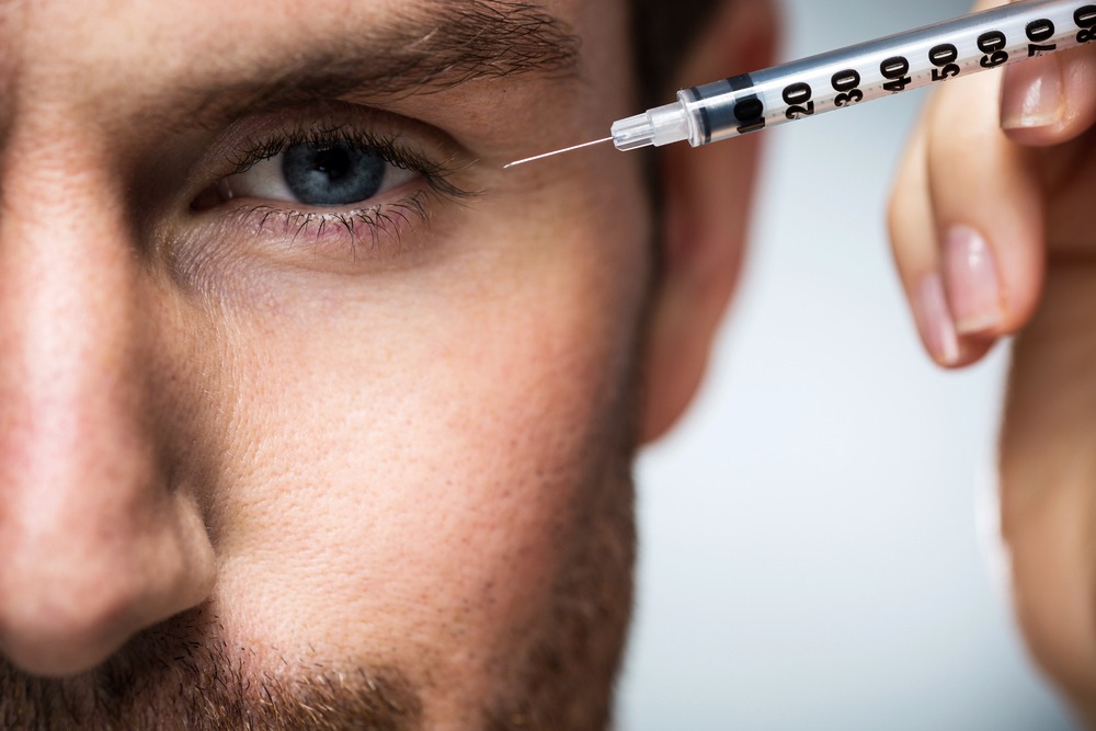 botox for guys in San Diego