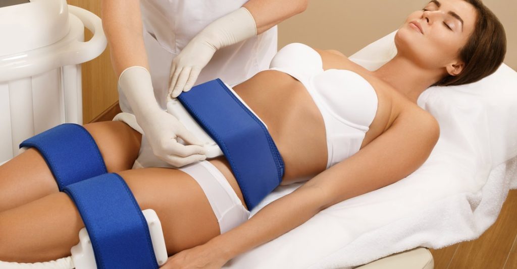 cryolipolysis