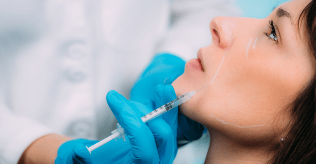 Dermal filler liquid facelift