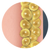 coolsculpt-step-4@2x