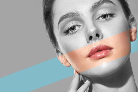 Person showing the effects of lip filler