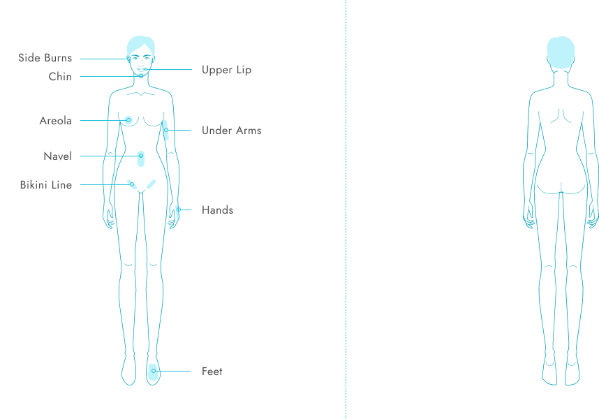 body chart for laser hair removal treatment areas