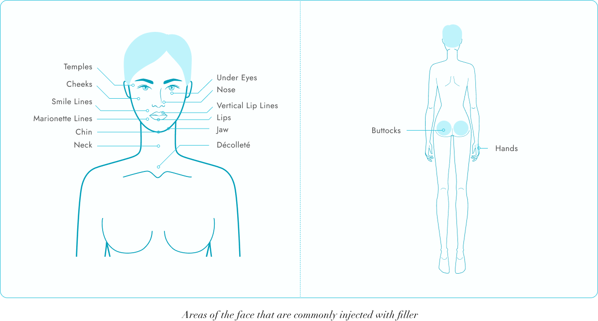 face and buttocks chart